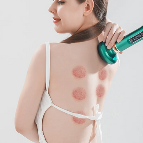 Masajeador Anticelulítico Celuvine™