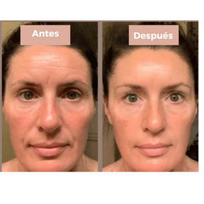 Mascarilla de colágeno Lunavia™