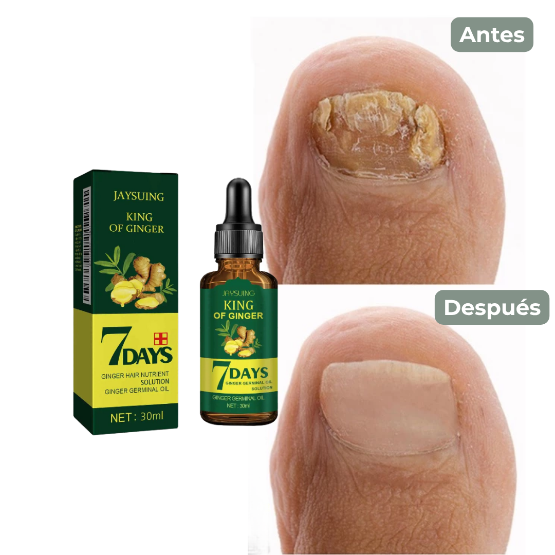 Tratamiento de los hongos de las uñas - Fungiclear™