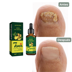 Tratamiento de los hongos de las uñas - Fungiclear™